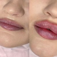 جشنواره لب فیلر ژل روسی بوتاکس زاویه سازی مادلینگ|خدمات آرایشگری و زیبایی|کرج, گوهردشت|دیوار