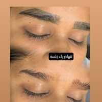 پاک کردن تتو.لیزرکیوسوییچ.کربن تراپی.روشن سازی|خدمات آرایشگری و زیبایی|اصفهان, سعادت‌آباد|دیوار