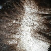 تعمیرات تخصصی پروتز مو ترمیم پروتزمو|خدمات آرایشگری و زیبایی|تهران, کوی فردوس|دیوار