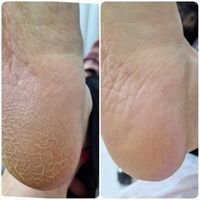 پدیکور تخصصی پا/ کف سابی|خدمات آرایشگری و زیبایی|مشهد, هاشمیه|دیوار
