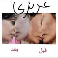 کرم معجزهvipصدرصداصلی ضدلک و روشن کننده|آرایشی، بهداشتی، درمانی|تهران, امامزاده حسن(ع)|دیوار