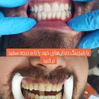 کلینیک دندانپزشکی ایت الله گلپایگانی(همایون)|خدمات آرایشگری و زیبایی|قم, حرم|دیوار