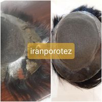 تعمیرات تخصصی پروتز مو ترمیم پروتزمو|خدمات آرایشگری و زیبایی|تهران, کوی فردوس|دیوار