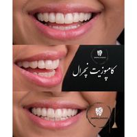دندانپزشکی درمانی و زیبایی با ‌موادروزوضمانت|خدمات آرایشگری و زیبایی|اسلام‌شهر, |دیوار