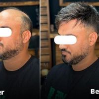 مرکز پروتز مو و کاشت مو|خدمات آرایشگری و زیبایی|اصفهان, خرم|دیوار