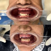 ایمپلنت متخصص دندانپزشک (تکنولوژی جدید)|خدمات آرایشگری و زیبایی|تهران, میرداماد|دیوار