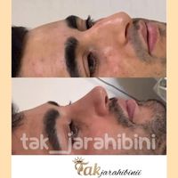 عمل بینی / جراحی زیبایی|خدمات آرایشگری و زیبایی|تهران, میدان ولیعصر|دیوار