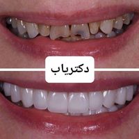 عمل زیبایی درمانی دندان دهان و دندانپزشکی دکتریاب|خدمات آرایشگری و زیبایی|شیراز, معالی‌آباد|دیوار