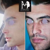 عمل بینی با متخصص گوش ، حلق و بینی|خدمات آرایشگری و زیبایی|تهران, میرداماد|دیوار