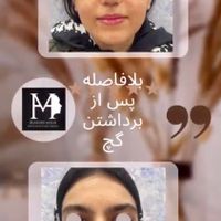 عمل بینی با متخصص گوش ، حلق و بینی|خدمات آرایشگری و زیبایی|تهران, میرداماد|دیوار