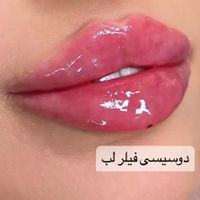 آموزش فوق تخصصی ژل فیلر بوتاکس مزو نخ (مطب)|خدمات آموزشی|تهران, جردن|دیوار