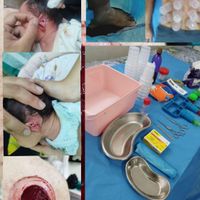 حجامت فصد زالو بادکش طب سوزنی فیزیوتراپی|خدمات آرایشگری و زیبایی|تهران, ایران|دیوار