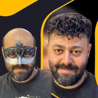 مرکز تخصصی پروتزمو /ترمیم مو در اصفهان|خدمات آرایشگری و زیبایی|اصفهان, خرم|دیوار