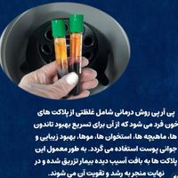 انجام prp با بهترین کیفیت و کمترین قیمت|خدمات آرایشگری و زیبایی|تهران, گیشا (کوی نصر)|دیوار