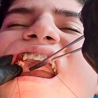 ارتودنسی.عصب کشی.کامپوزیت.روکش|خدمات آرایشگری و زیبایی|تهران, مجیدیه|دیوار