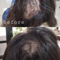 تزریق ژل لب و گونه و چانه و..(جشنواره)درمطب|خدمات آرایشگری و زیبایی|اصفهان, ملک‌شهر|دیوار