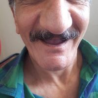 دندانسازی/دندان مصنوعی/دندان متحرک/لثه ژله ای|خدمات آرایشگری و زیبایی|شیراز, پانصد دستگاه (بلوار رحمت)|دیوار