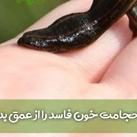 گردهمایی حجامت|گردهمایی و همایش|کرج, عظیمیه|دیوار