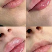 خدمات زیبایی پوست مو لیزر الکساندرایت|خدمات آرایشگری و زیبایی|کرج, مشکین‌دشت|دیوار