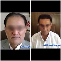 کاشت مو شریفی-تضمینی-۱۸ سال سابقه-تیم شیرازی|خدمات آرایشگری و زیبایی|یزد, |دیوار