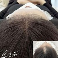 مدل (آقا و خانوم ) برای کار میکرو اسکالپ|خدمات آرایشگری و زیبایی|تهران, نیاوران|دیوار