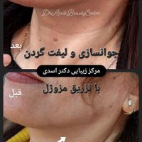 مرکز زیبایی دکتر اسدی (بوتاکس لیزر هایفو فیلر)|خدمات آرایشگری و زیبایی|تهران, نیاوران|دیوار