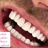 کلینیک تخصصی دندانپزشکی عصب کشی ترمیم کامپوزیت|خدمات آرایشگری و زیبایی|تهران, پیروزی|دیوار