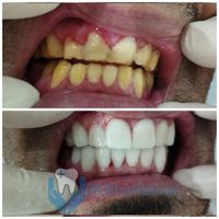 افتتاح کلینیک خیریه دندانپزشکی|خدمات آرایشگری و زیبایی|اصفهان, بیست و چهار متری|دیوار