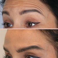 مادلینگ صورت،بوتاکس،لب روسی بانوان و آقایان|خدمات آرایشگری و زیبایی|تهران, توحید|دیوار