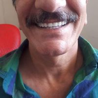 دندانسازی/دندان مصنوعی/دندان متحرک/لثه ژله ای|خدمات آرایشگری و زیبایی|شیراز, پانصد دستگاه (بلوار رحمت)|دیوار