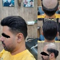 مرکز پروتز مو و کاشت مو|خدمات آرایشگری و زیبایی|اصفهان, خرم|دیوار