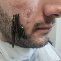 تخصصی پی آر پیprpحرفه ای بوتاکس ژل حجامت70فیلر فصد|خدمات آرایشگری و زیبایی|اصفهان, وحید|دیوار