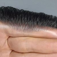 مرکز فروش انواع پروتز مو وارداتی اورجینال|آرایشی، بهداشتی، درمانی|تهران, کوی فردوس|دیوار