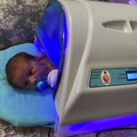 اجاره دستگاه زردی نوزاد(فتوتراپی)۲۴ساعته کل تهران|خدمات آرایشگری و زیبایی|تهران, نارمک|دیوار
