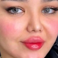 تزریق ژل.بوتاکس.مزوتراپی.فشیال.جوانساز|خدمات آرایشگری و زیبایی|تهران, پیروزی|دیوار