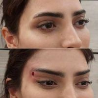 ژل بوتاکس کانتورینگ لیفت بانخ|خدمات آرایشگری و زیبایی|تهران, صادقیه|دیوار