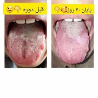 تشخیص و درمان بیماریها از روی عکس زبان|خدمات آرایشگری و زیبایی|تایباد, |دیوار