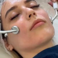 فیشیال ،پلاژن تراپی ، کربوکسی تراپی‌ ، آبرسانی|خدمات آرایشگری و زیبایی|تهران, شهرک غرب|دیوار