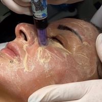 مدل بیبیگلو و مزونیدلینگ پوست کره ای|خدمات آرایشگری و زیبایی|تهران, هفت حوض|دیوار