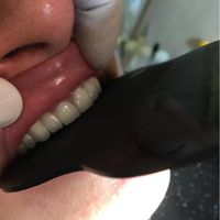خدمات دندانپزشکی و دندانسازی مستر دِنت|خدمات آرایشگری و زیبایی|ارومیه, |دیوار