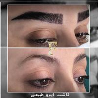 کاشت مو ابرو ریش بدون جراحی با پیشرفته ترین روش|خدمات آرایشگری و زیبایی|تهران, الهیه|دیوار