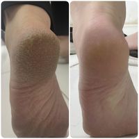 پدیکور تخصصی پا/ کف سابی|خدمات آرایشگری و زیبایی|مشهد, هاشمیه|دیوار