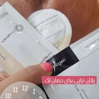 /پاکسازی/ فیشال تخصصی/ پلاژن تراپی|خدمات آرایشگری و زیبایی|تهران, شهرک ولیعصر|دیوار