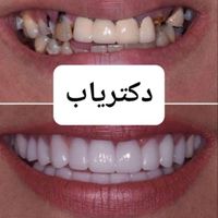 عمل زیبایی درمانی دندان دهان و دندانپزشکی دکتریاب|خدمات آرایشگری و زیبایی|شیراز, معالی‌آباد|دیوار