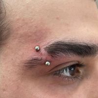 آموزش مزو، لیفت نخ،پیرسینگ،هایفو وفیشیال توسط پزشک|خدمات آرایشگری و زیبایی|تهران, افسریه|دیوار