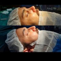 جراحی بینی فقط دو نفربرای سه شنبه|خدمات آرایشگری و زیبایی|تهران, نازی‌آباد|دیوار