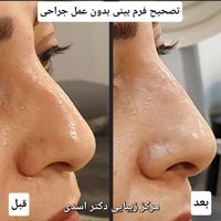 مرکز زیبایی دکتر اسدی (بوتاکس لیزر هایفو فیلر)|خدمات آرایشگری و زیبایی|تهران, نیاوران|دیوار