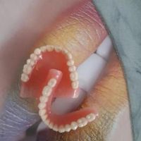 دندانسازی/دندان مصنوعی/دندان متحرک/لثه ژله ای|خدمات آرایشگری و زیبایی|شیراز, پانصد دستگاه (بلوار رحمت)|دیوار