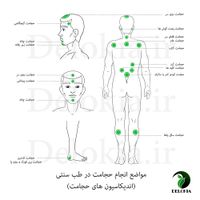 حجامت ، فصد ، زالو، بادکش ورگ گیری تخصصی|خدمات آرایشگری و زیبایی|قم, توحید|دیوار