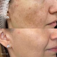 مدل بیبیگلو و مزونیدلینگ پوست کره ای|خدمات آرایشگری و زیبایی|تهران, هفت حوض|دیوار